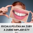 Rychlá půjčka na zuby a zubní implantáty až 750000 Kč
